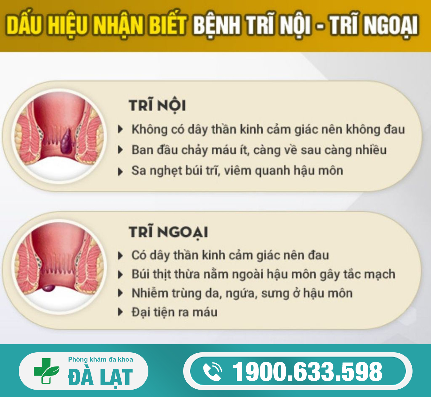 Hình ảnh minh họa